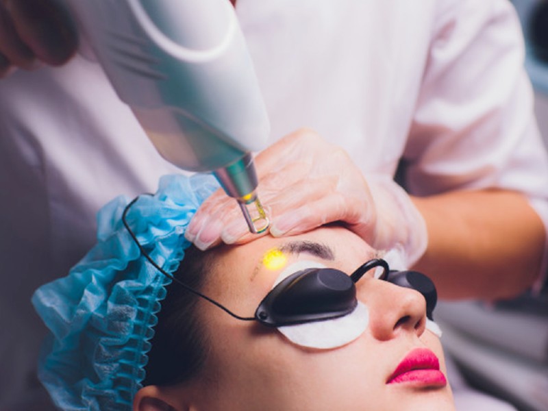 Cách xóa xăm lông mày đảm bảo không để lại sẹo #43 Cách xóa xăm lông mày đảm bảo không để lại sẹo